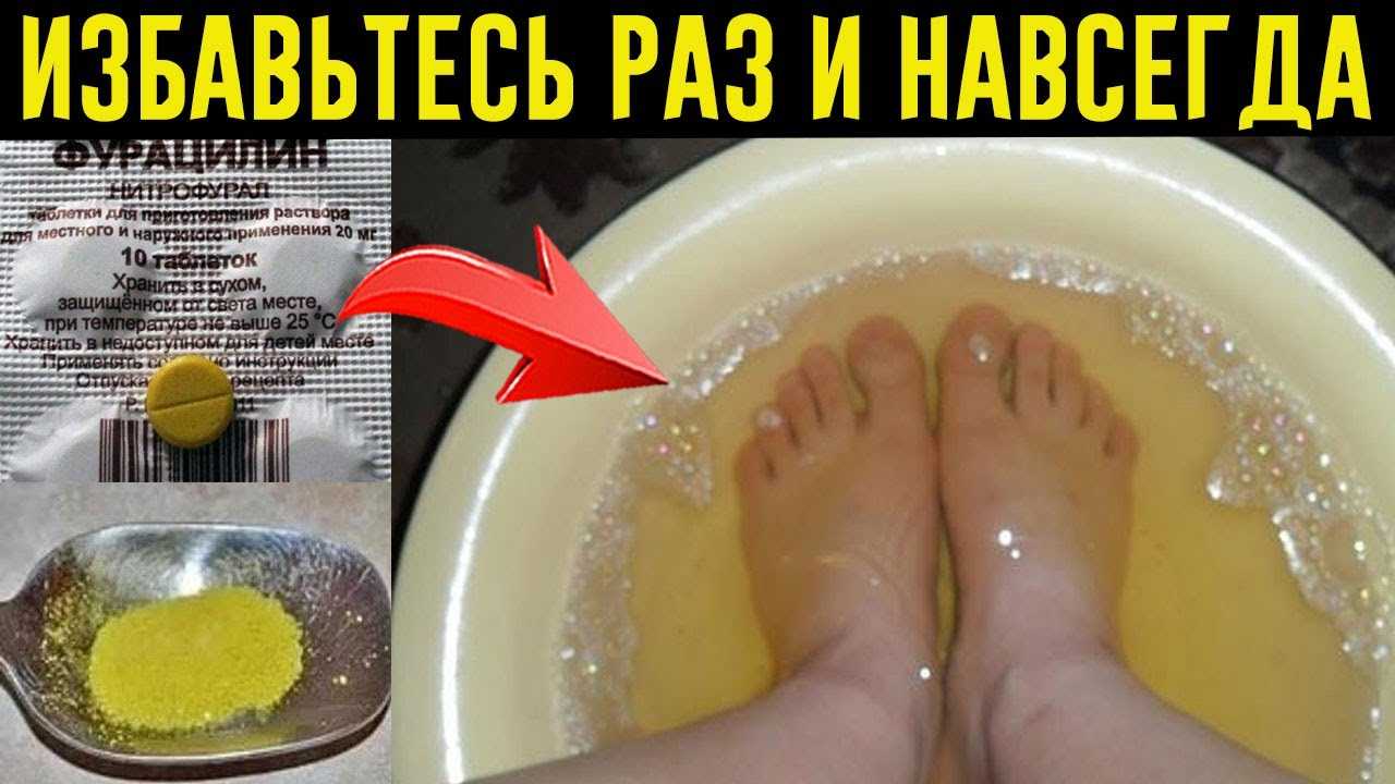 Как избавиться от запаха в кроссовках быстро?
как избавиться от запаха в кроссовках быстро?