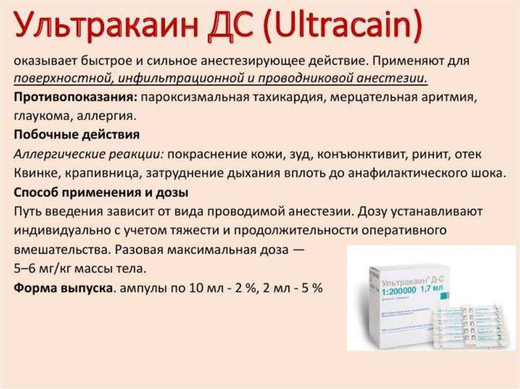 Ультракаин в стоматологии: показания, дозировка и эффективность