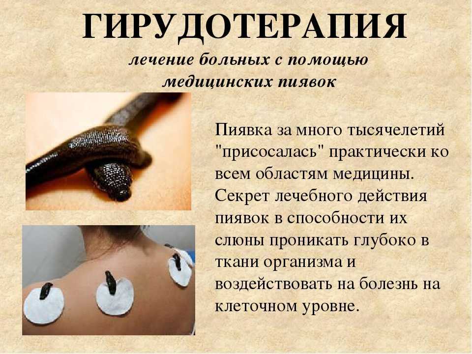 Как содержать пиявки после одного использования. требования к хранению медицинских пиявок