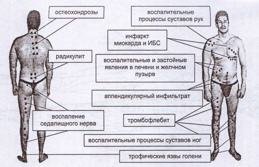 Как хранить медицинских пиявок в домашних условиях