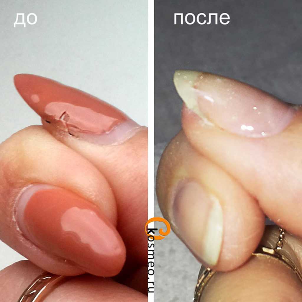Что делать если сломался ноготь: сбоку, посередине или у основания; как отремонтировать